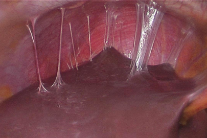 BUÜ’lü akademisyenin projesi “fıtık” oluşumunu engelleyecek