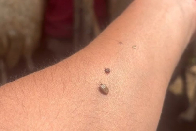 Uzmanından kene uyarısı; Kapalı giysileri tercih edin!