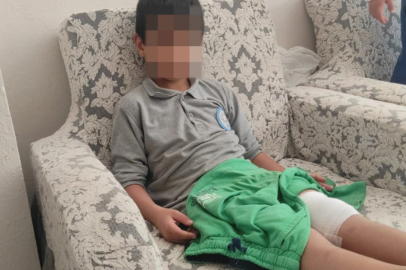 Okula giderken sokak köpeğinin saldırısına uğradı