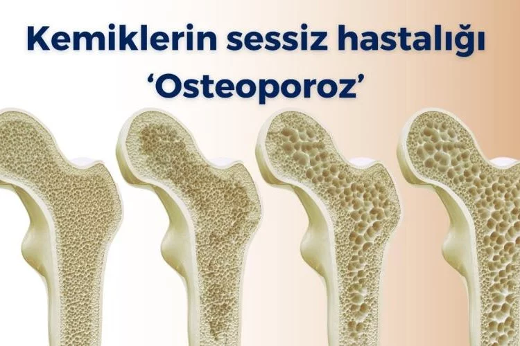 Kemiklerin sessiz hastalığı ‘osteoporoz’